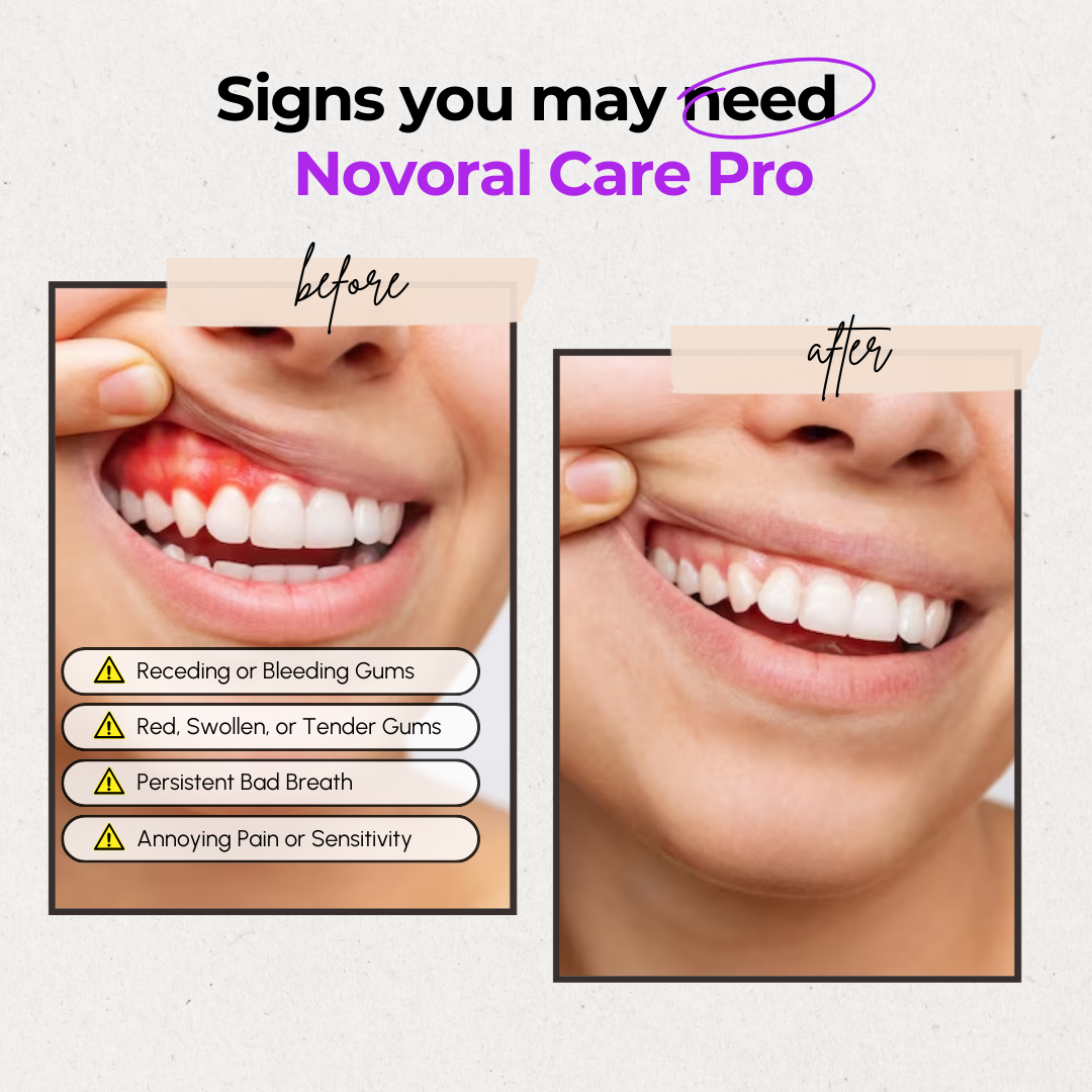 Novaa Oral Care Pro